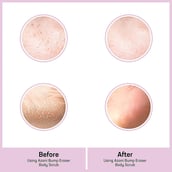 6 - Azani Active Care Bump Eraser Body Scrub, 100 g for All Skin Types (Pack of 2)